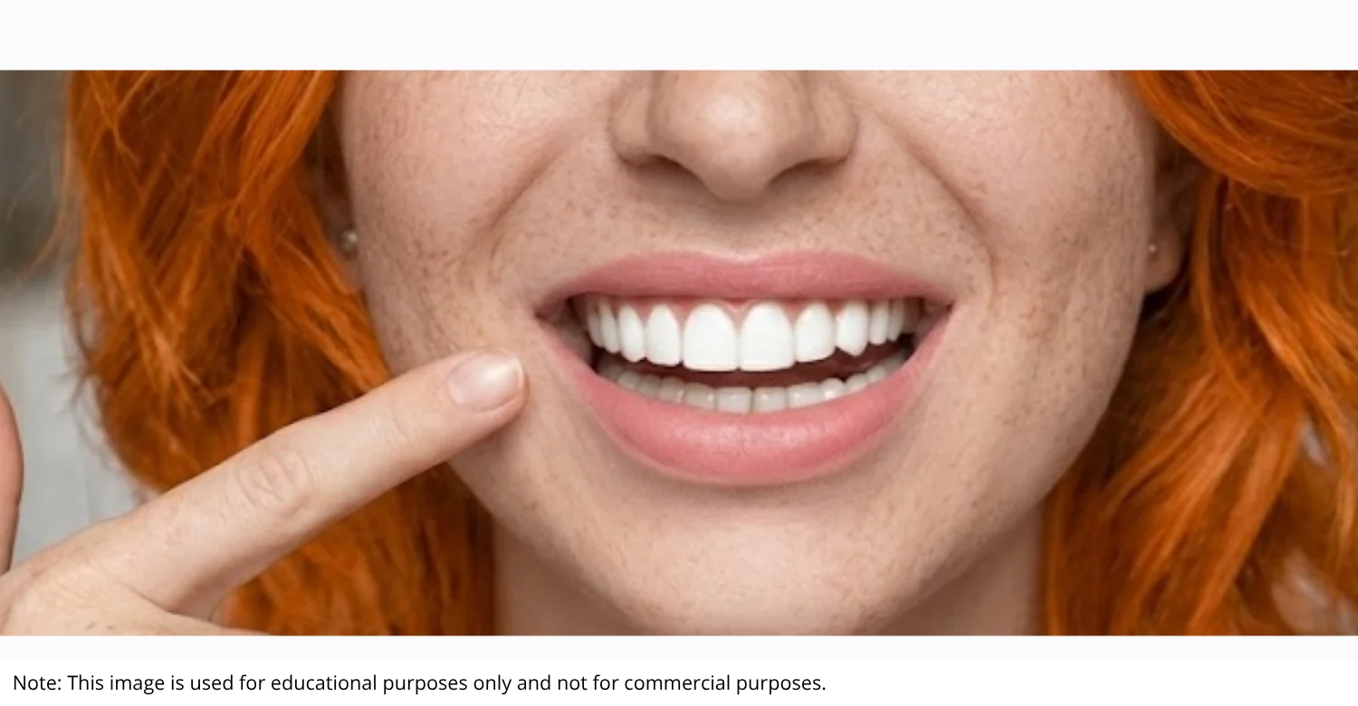 No Prep Veneers vs Traditional Veneers inblog